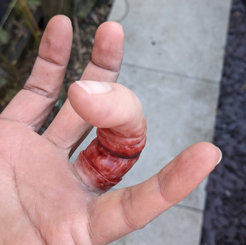 Wearable Degloved Silicone Finger Prosthetic - Image 4